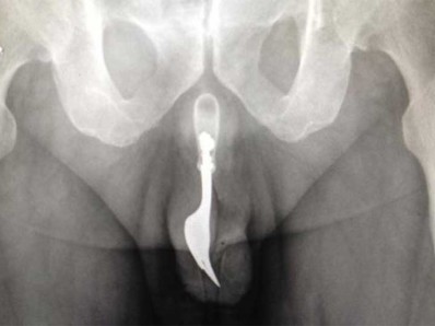 fork in cock