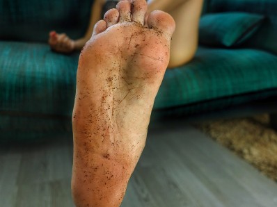 very dirty feet